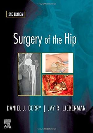 SURGERY OF THE HIP *
