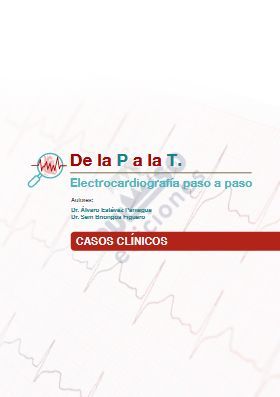 DE LA P A LA T. ELECTROCARDIOGRAFÍA PASO A PASO (SOLO ENVÍO WEB) *