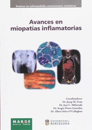 AVANCES EN MIOPATÍAS INFLAMATORIAS *