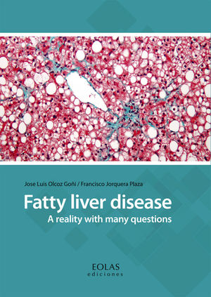 FATTY LIVER DISEASE *