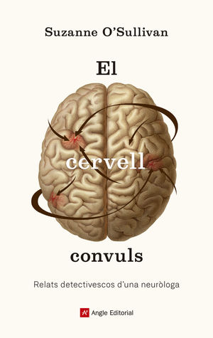 EL CERVELL CONVULS  *