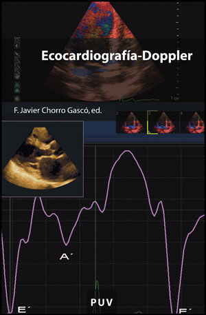 ECOCARDIOGRAFÍA-DOPPLER *