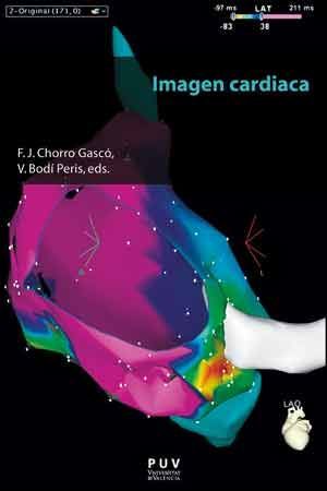 IMAGEN CARDIACA *