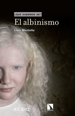 EL ALBINISMO *
