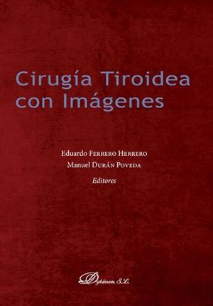 CIRUGÍA TIROIDEA CON IMÁGENES *